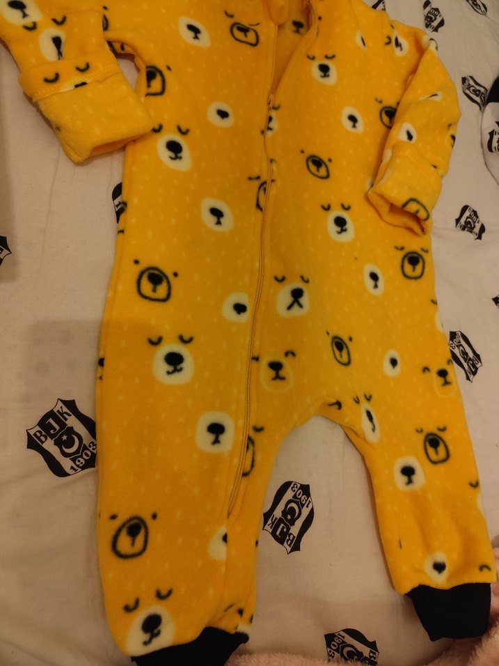 Kapüşonlu Sarı Bebek Tulum - Görsel 3