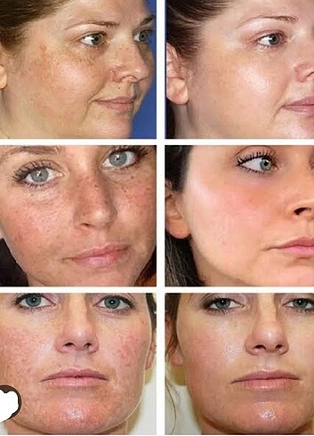 Kanza beyazlatıcı Krem  - Görsel 2