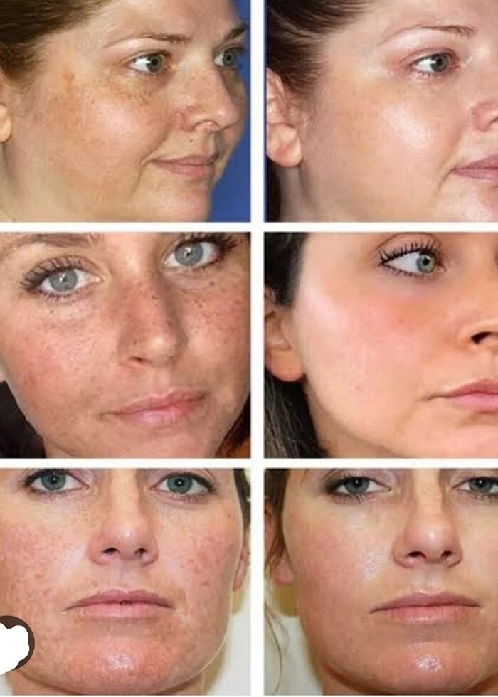 Kanza beyazlatıcı Krem  - Görsel 2