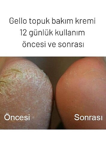 Ayak bakım kremi  - Görsel 4