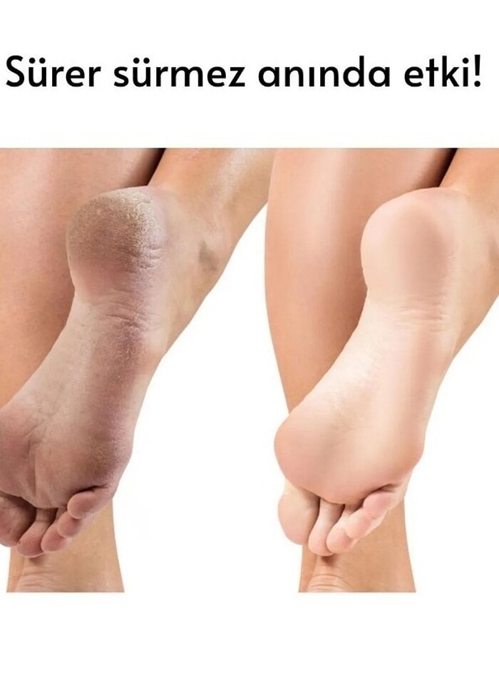 Ayak bakım kremi  - Görsel 3