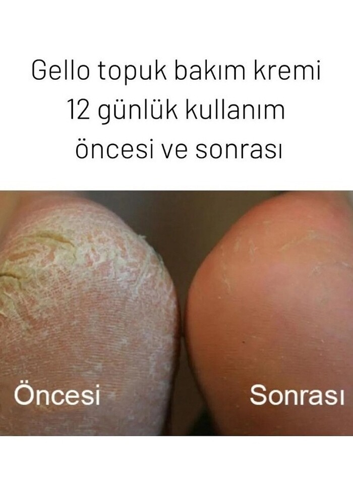 Ayak bakım kremi  - Görsel 4