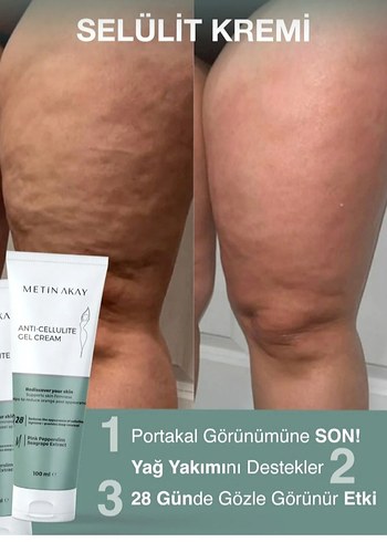 Metin Akay Selülit Karşıtı Krem 100 ml - Görsel 4