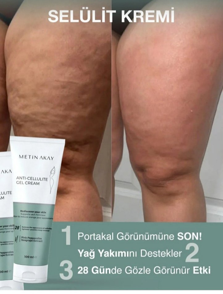 Metin Akay Selülit Karşıtı Krem 100 ml - Görsel 4