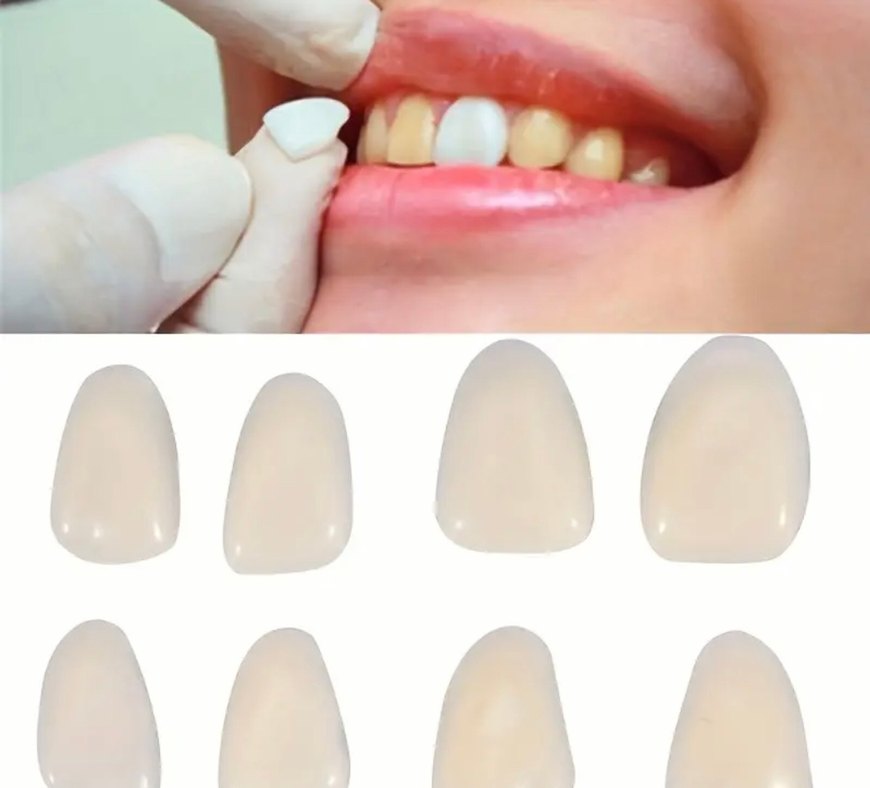 60lı ultra ince beyaz diş kaplaması - Görsel 2