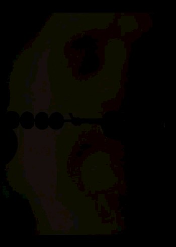 Gri Askısız Hemşirelik Atlet - Görsel 2