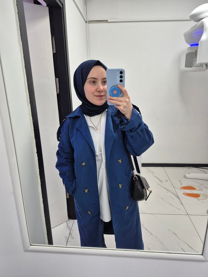 milla trençkot - Görsel 2