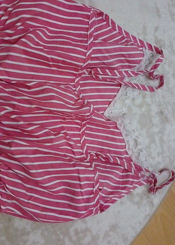 Dantel Detaylı Pembe Çizgili kadin Tulum - Görsel 5