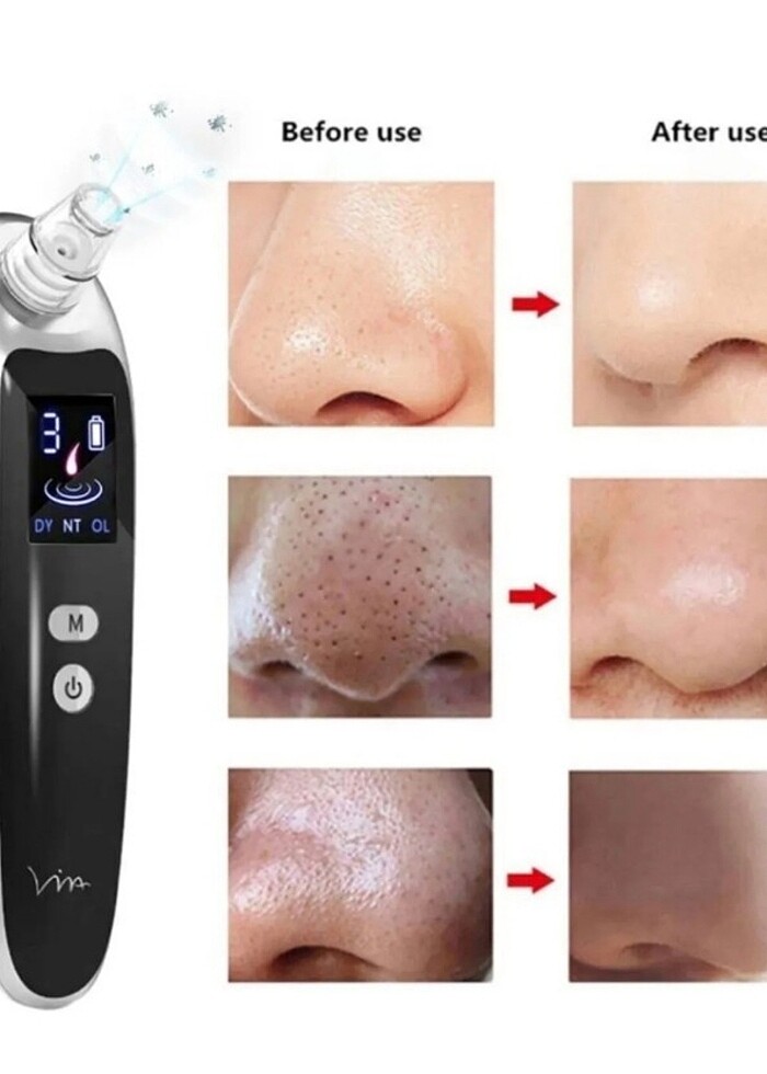 Vakumlu temizleyici - Görsel 4