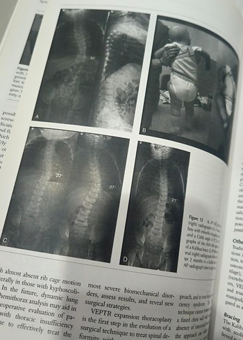 ortopedi kitap  2010 AAOS Instructional Course Lectures Kitabı - Görsel 4