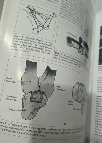 ortopedi kitap  2010 AAOS Instructional Course Lectures Kitabı - Görsel 9