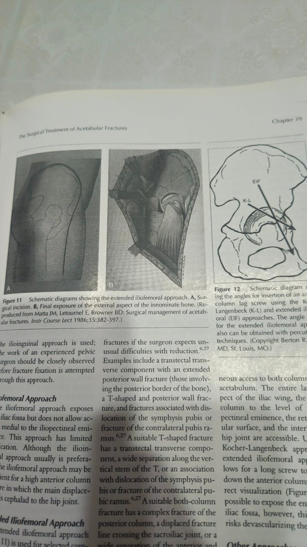 ortopedi kitap  2010 AAOS Instructional Course Lectures Kitabı - Görsel 5