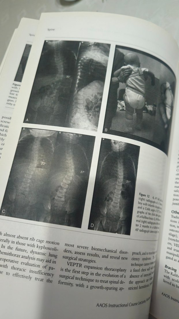 ortopedi kitap  2010 AAOS Instructional Course Lectures Kitabı - Görsel 4