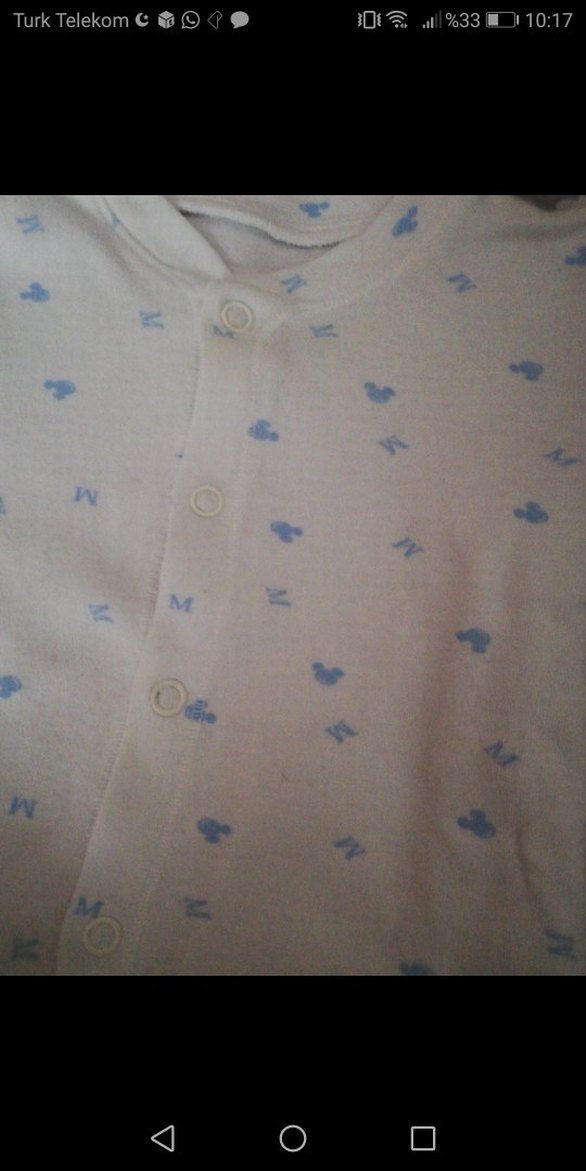 Bebek Hastane Tulumu ve Eldiven Seti - Görsel 2