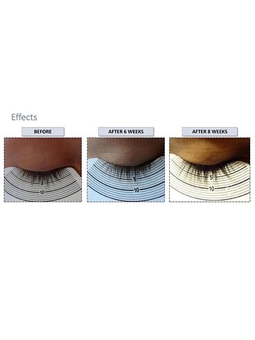  Beden Renk Long4lashes Fx5 Kirpik Serumu