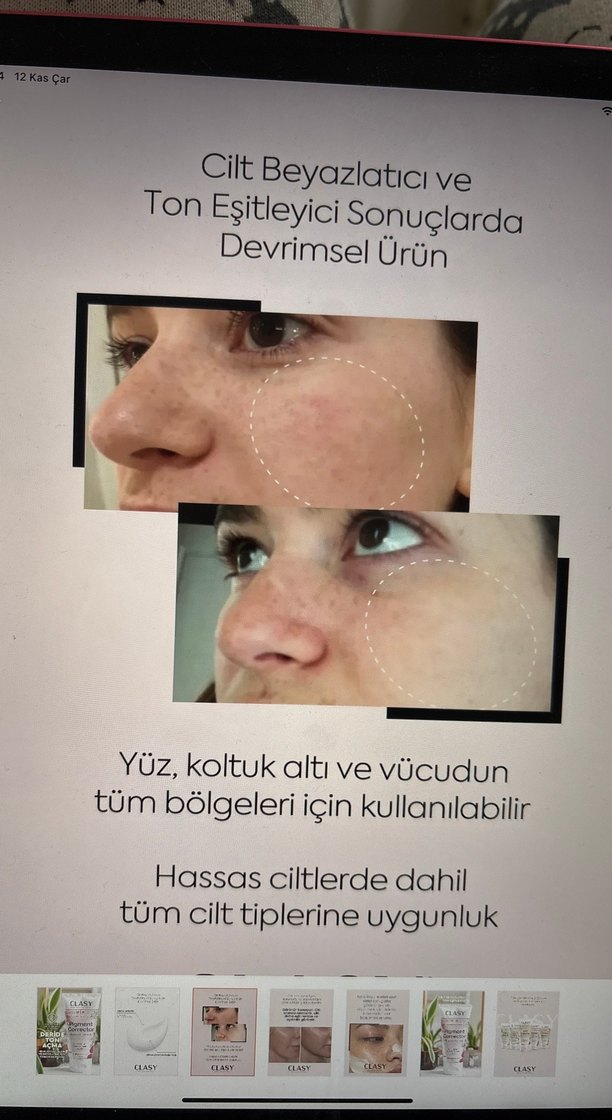 clasy cilt tonu eşitleyici krem - Görsel 3