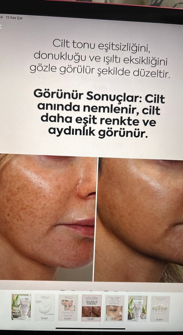 clasy cilt tonu eşitleyici krem - Görsel 4