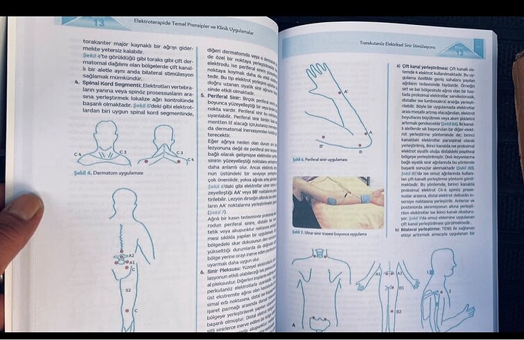 Elektroterapide Temel Prensipler ve klinik destek Uyg - Görsel 2