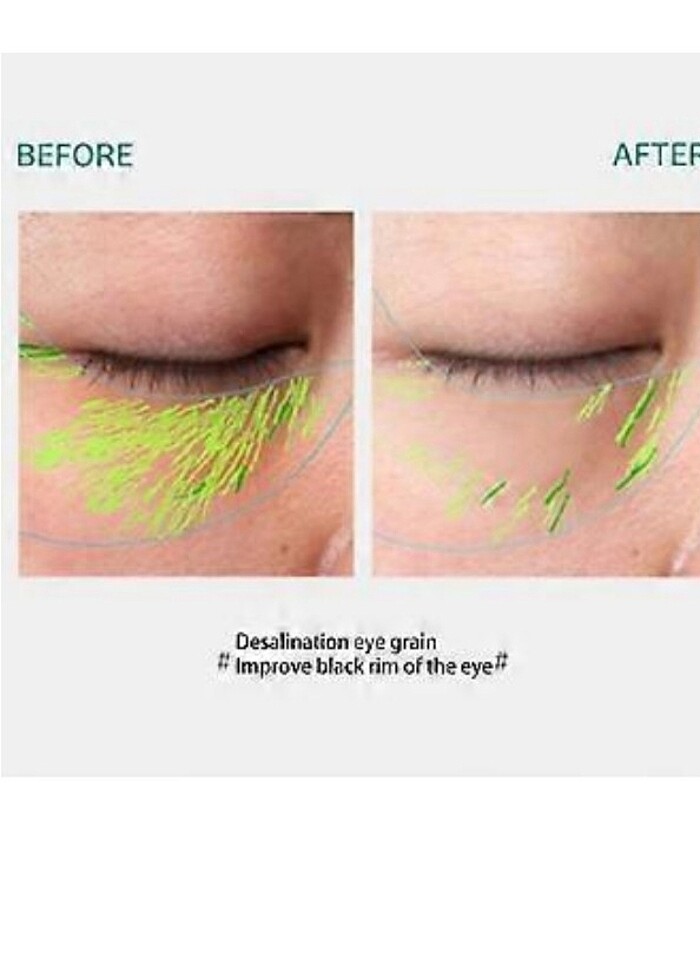 3'ü 1 arada kırışıklık önleyici yüz boynu için yüz masajı, titre - Görsel 2