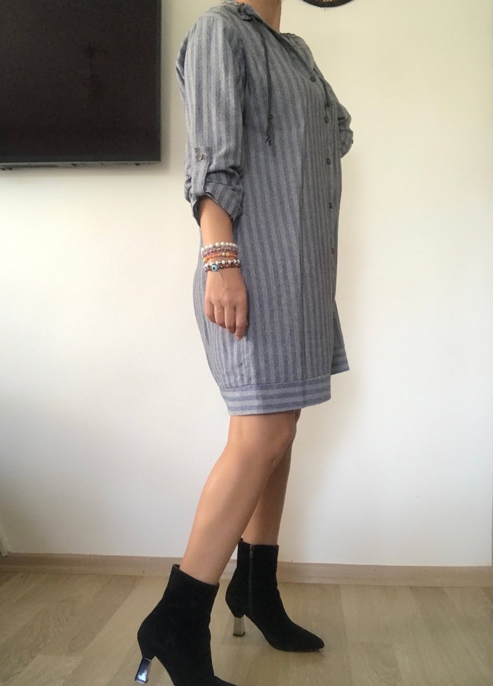 Çizgili düğmeli tunik - Görsel 2