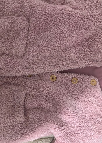 Kız Çocuk Pembe Kürklü Ceket - Görsel 2