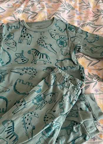 Gri Desenli Bebek Hastane Kıyafeti - Görsel 5