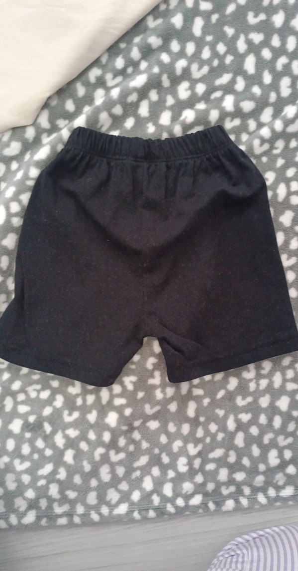 Kız Bebek Kiraz Baskılı Şortlu Takım - Görsel 3