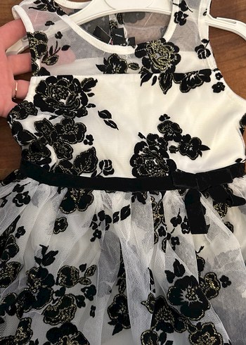 Dantelli Siyah Beyaz Kız Elbisesi - Görsel 7