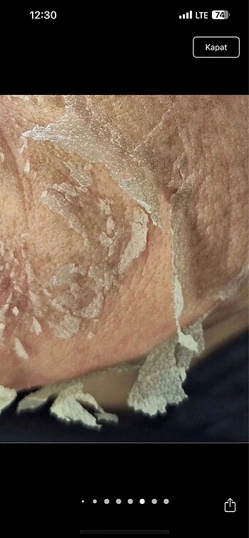 Yosun peeling mesonatural