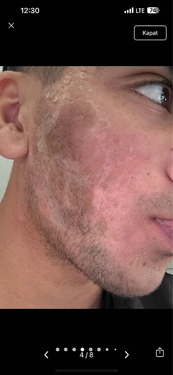 Beden Renk Yosun peeling mesonatural