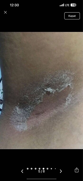 Yosun peeling mesonatural - Görsel 5