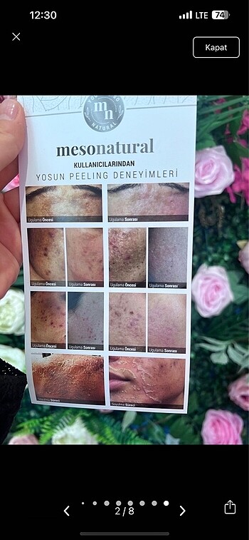 Beden Yosun peeling mesonatural