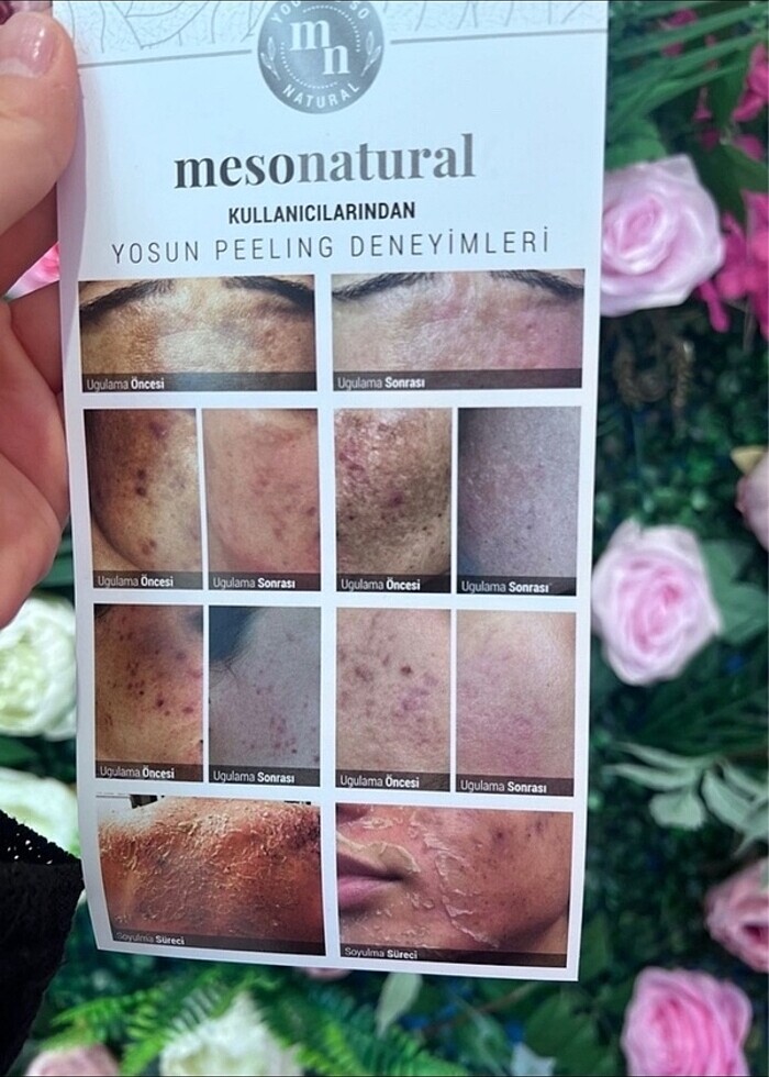 Yosun peeling mesonatural - Görsel 3