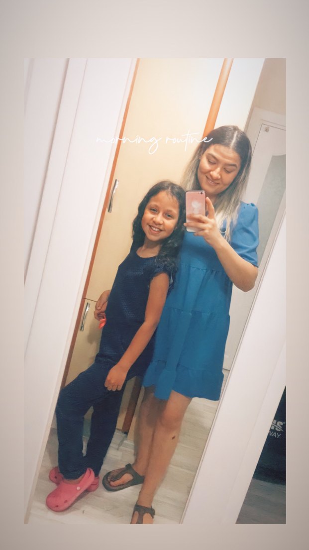 Mavi renk kısa elbise - Görsel 2