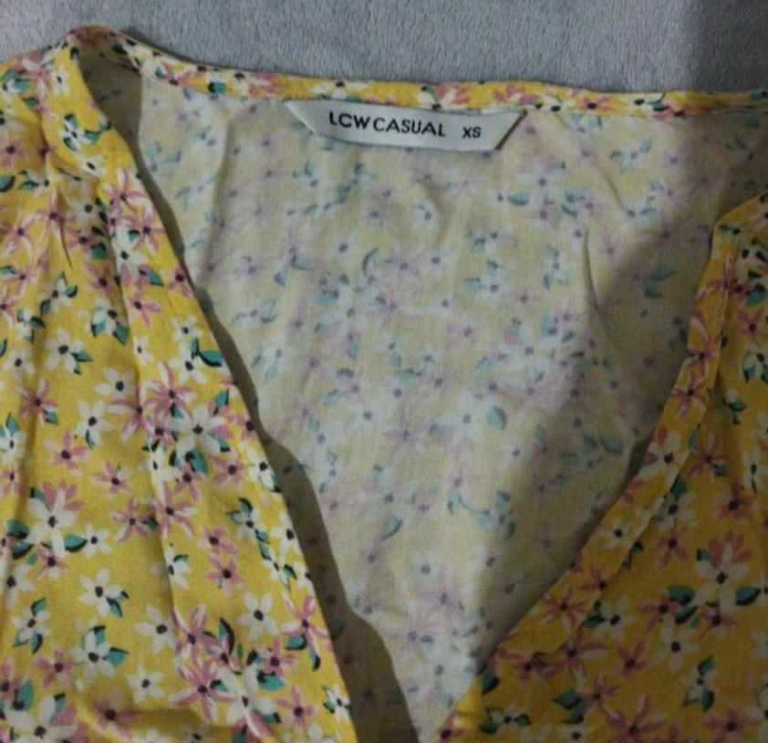 Sarı Midi Boy V-Yaka Düğmeli Elbise - Görsel 3