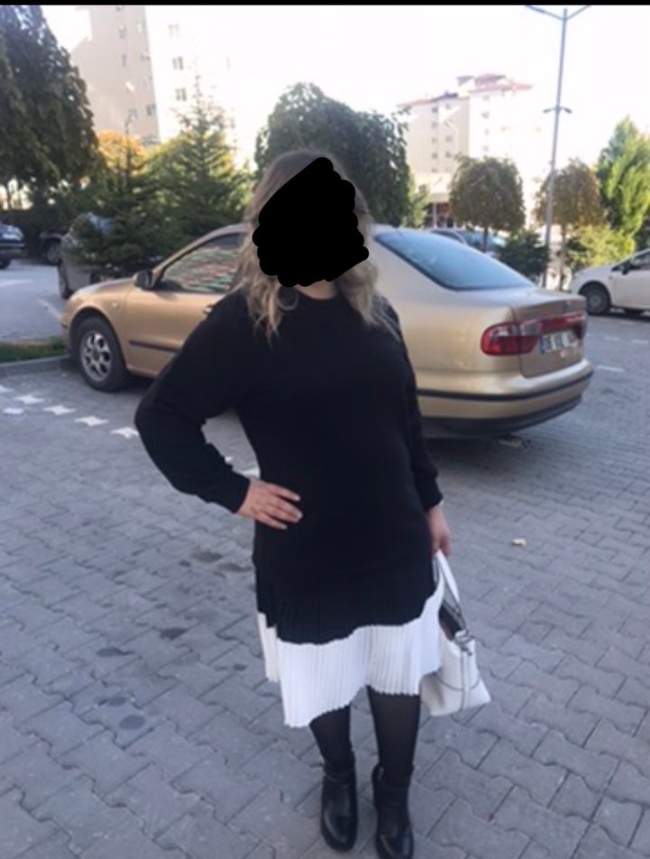 Siyah Piliseli Midi Triko Elbise - Görsel 2