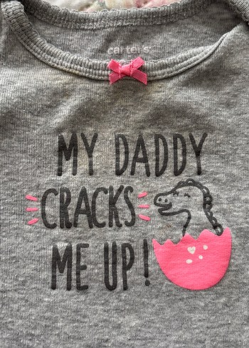 Kısa Kollu Bebek Body Zıbın Seti - Görsel 4