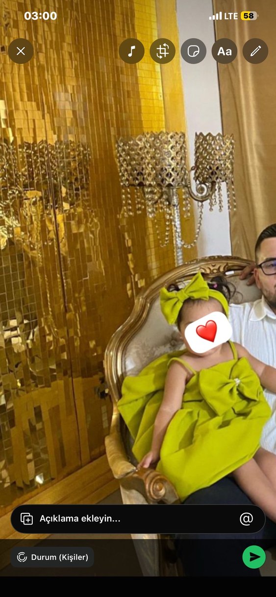 Fiyonklu Çocuk Elbisesi ve Saç Bandı - Görsel 2