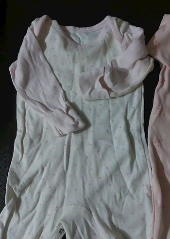 Düğmeli Pembe Bebek Tulumu Seti - Görsel 4