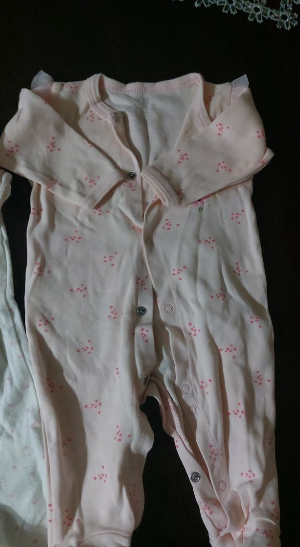 Düğmeli Pembe Bebek Tulumu Seti - Görsel 3