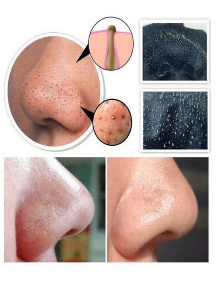 Ostwint Soyulabilir Siyah Maske 150ml - Görsel 3