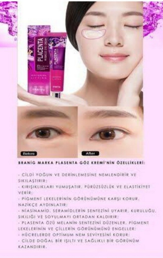 Branig Plasenta Göz Çevresi Kremi - Görsel 2