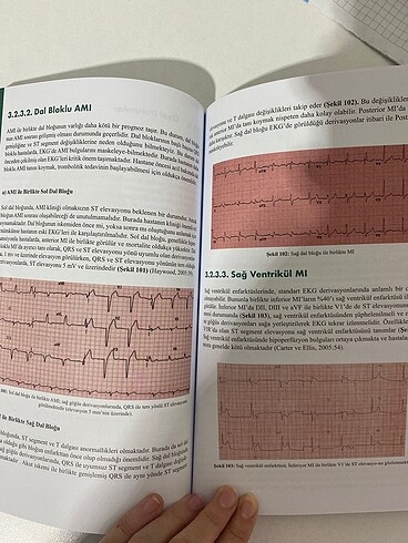  Beden Ema Tıp EKG