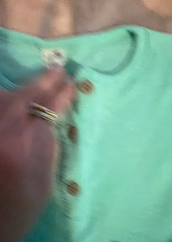 Düğmeli Turkuaz Bebek Kız Takımı - Görsel 2