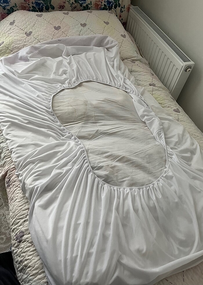 Beşik alez - Görsel 2