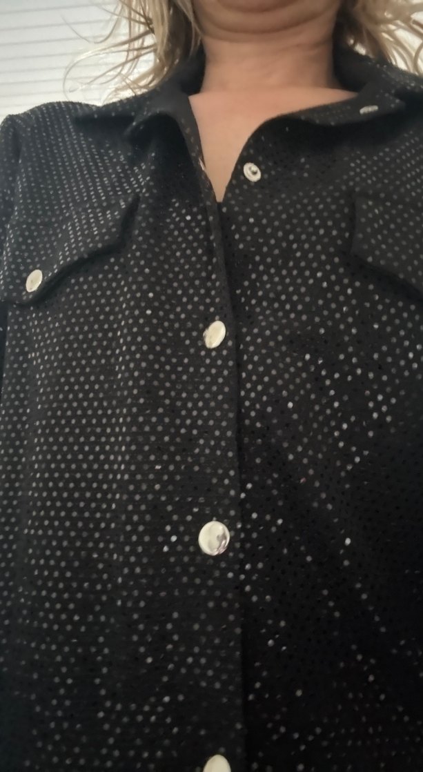 Düğmeli Parlak Gri Telefon Kılıfı - Görsel 4