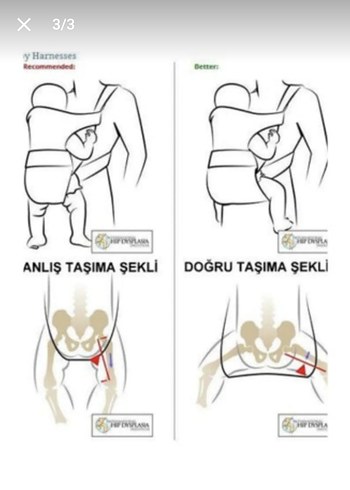 Beden Eggbaby Bebek taşıma kangurusu ergonomik kanguru