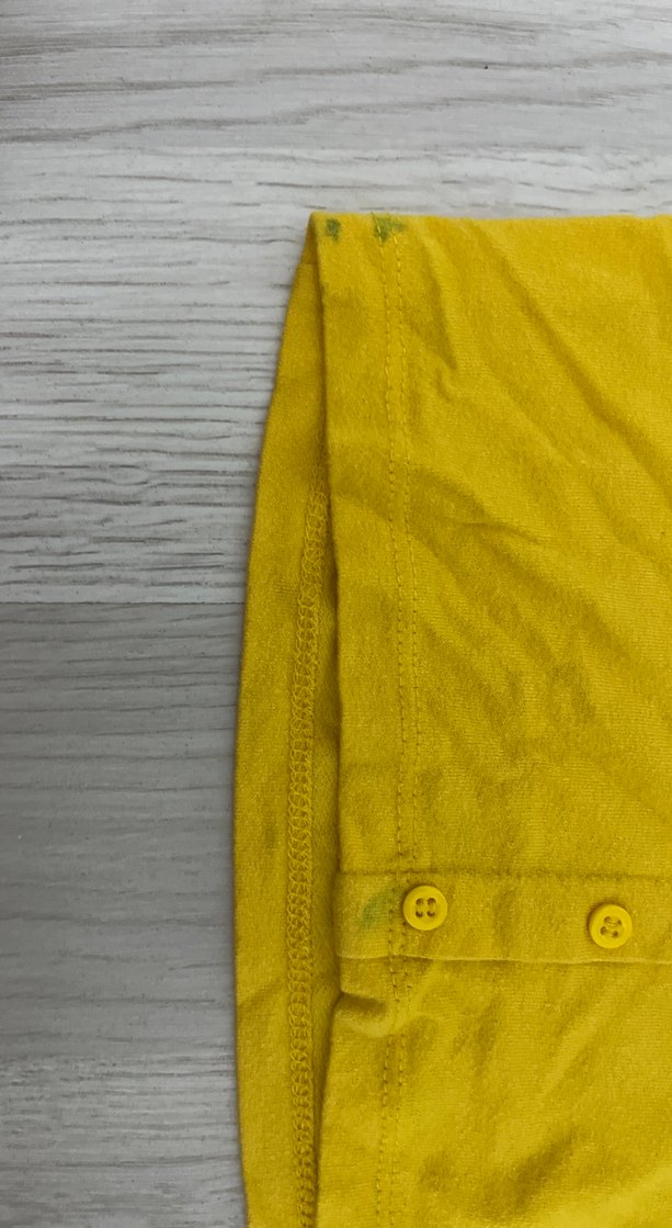 Düğmeli Sarı Kadın Kısa Kollu Tişört - Görsel 2