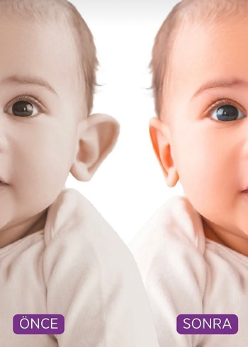 Earlap Baby Bebek Kepçe Kulak Bandı - Görsel 5