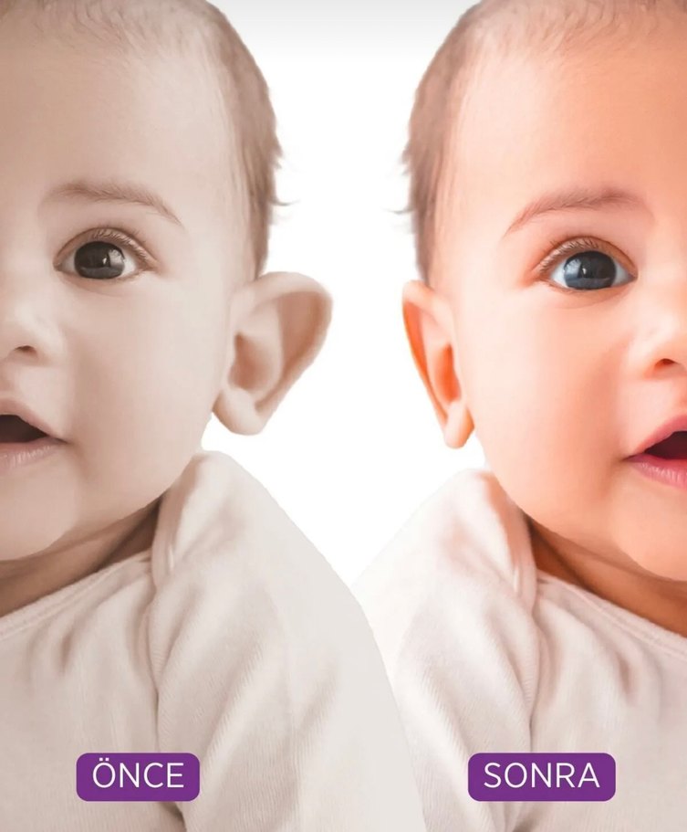 Earlap Baby Bebek Kepçe Kulak Bandı - Görsel 5